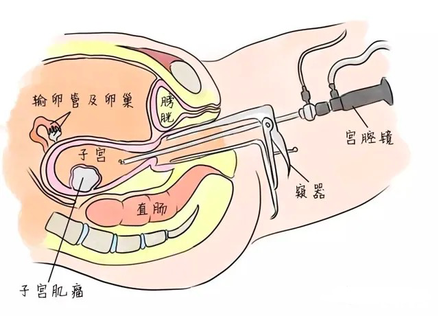 1690424580609455.png 640.png